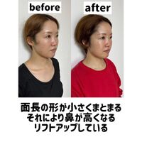 画像1451