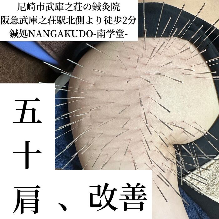 画像1571