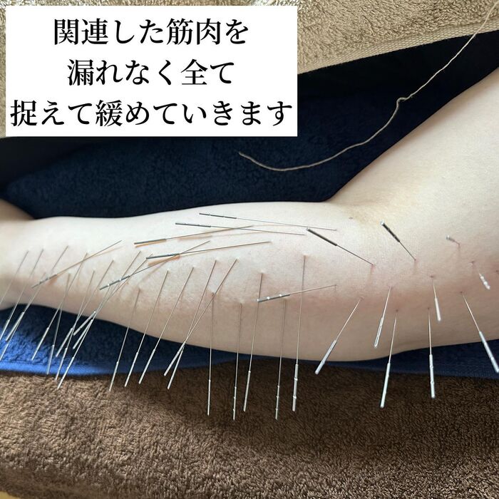 画像1573