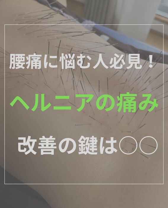 画像1943